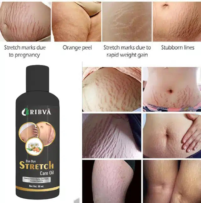 Ribva Stretch Care Oil (50 ml)